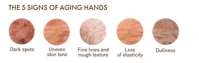 5 signs of aging hands